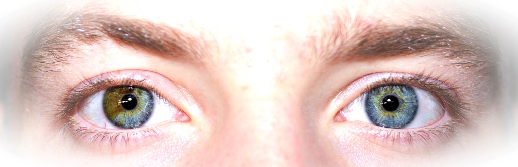 mata pemilik kondisi heterochromia parsial © Wikimedia Commons/Tazztone